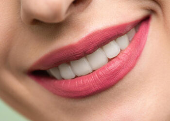 A Hollywood smile with dental esthetics: the possibilities of modern dental medicine Teaser